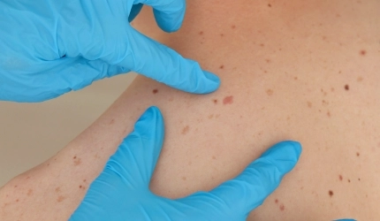 Dra. Marcia Lima Infectologista Presidente Prudente